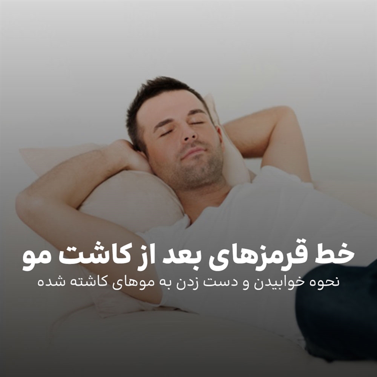 دست زدن به موهای کاشته شده + نحوه خوابیدن بعد از کاشت مو