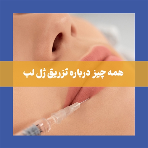 تزریق ژل لب و قیمت انواع برندها و عوارض ژل لب