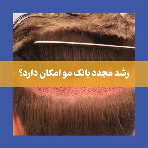 آیا بانک مو دوباره رشد میکند؟