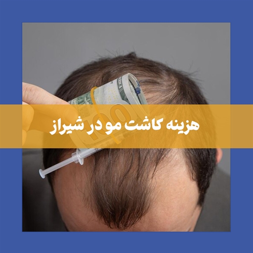 بررسی عوامل موثر بر روی هزینه کاشت مو شیراز