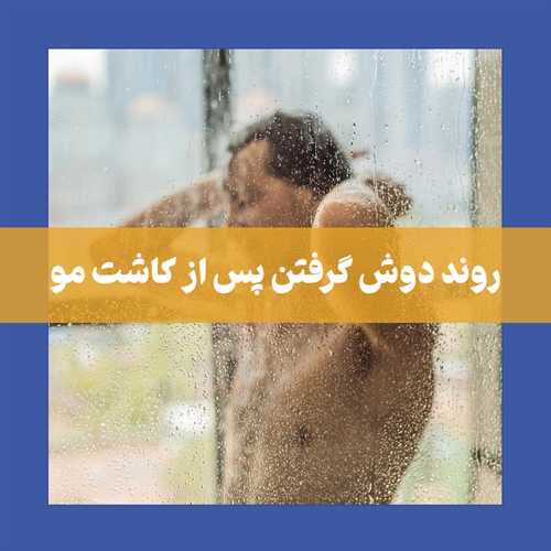 چند روز بعد از کاشت مو می‌توان دوش گرفت؟