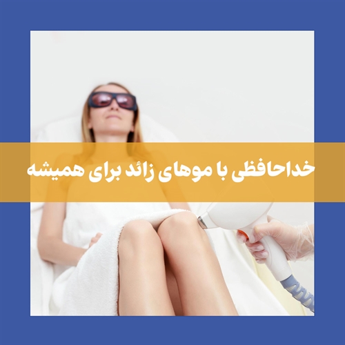 لیزر موتوس چیست و چه برتری‌هایی نسبت به لیزر کندلا دارد؟