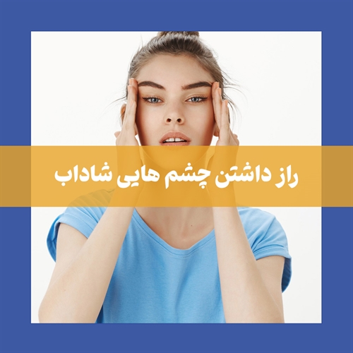 همه چیز در مورد بوتاکس دور چشم