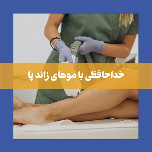 لیزر پا + مزایا و معایب لیزر مو پا 
