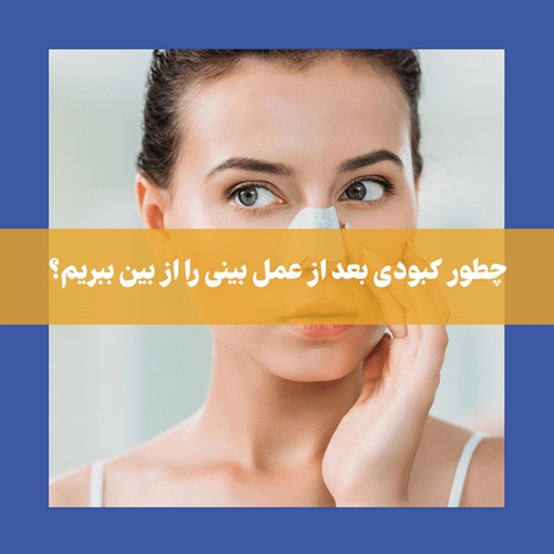 برای رفع کبودی بعد از جراحی بینی چه باید کرد؟
