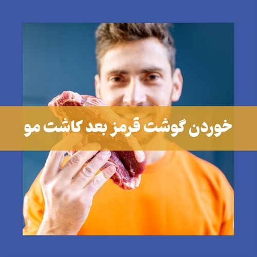 آیا مصرف گوشت قرمز بعد از کاشت مو مجاز است؟
