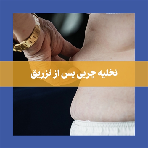 چگونه چربی تزریق شده را از بین ببریم؟
