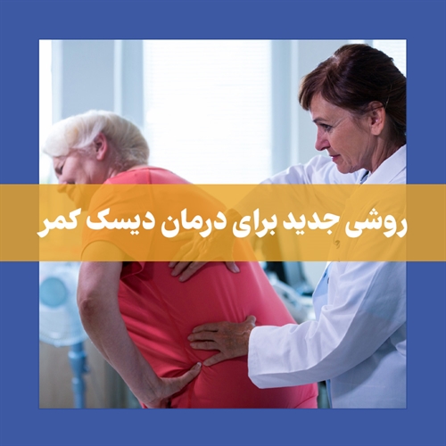 تزریق دیسکوژل برای درمان دیسک کمر