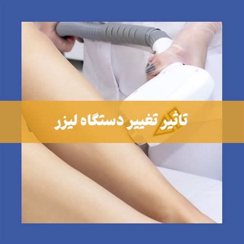 اگر دستگاه لیزر را عوض کنیم چه میشود؟