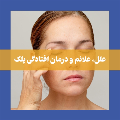 افتادگی پلک، معضلی در زیبایی چهره