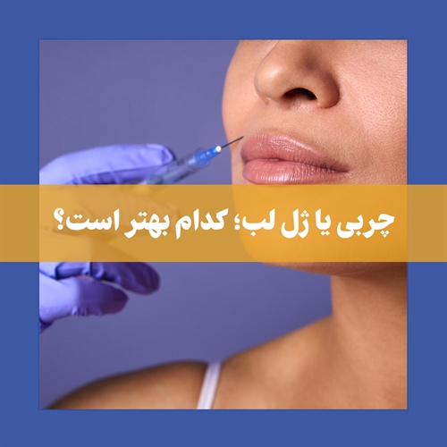تزریق ژل به لب بهتر است یا تزریق چربی؟