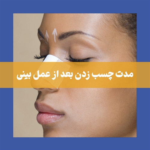 تا چند وقت بعد جراحی بینی باید چسب زد؟ 