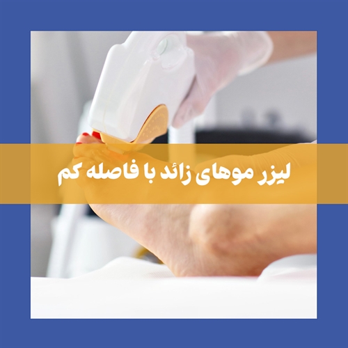 اگر فاصله بین جلسات لیزر کم شود چه میشود؟