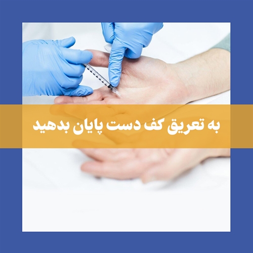درمان تعریق کف دست با بوتاکس: روشی موثر و بی‌ خطر