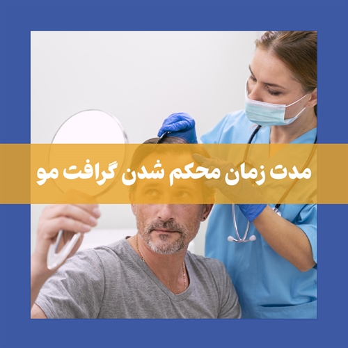مدت زمان محکم شدن گرافت مو بعد از کاشت مو