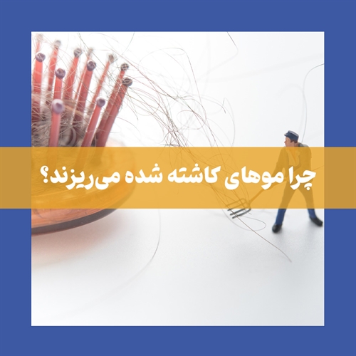 فاز استراحت موهای کاشته شده