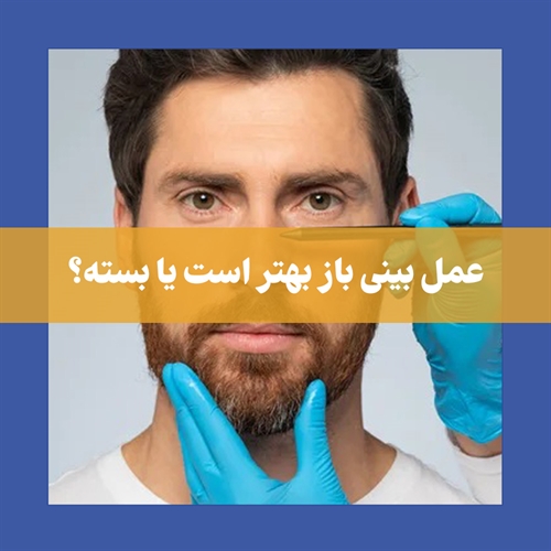 چرا عمل بسته بینی اینقدر محبوب شده است