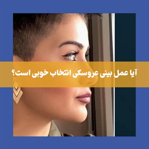 آیا عمل بینی عروسکی برای شما مناسب است؟