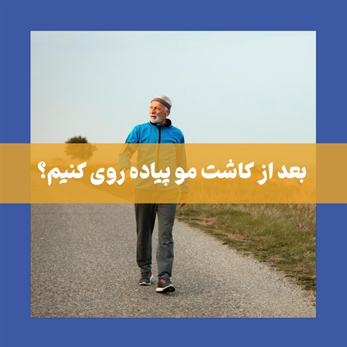 پیاده روی بعد از کاشت مو