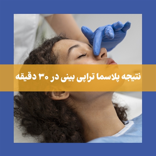 آیا پلاسما تراپی بینی باعث کوچک شدن بینی می‌شود؟