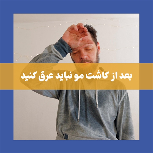  راهکارهای مقابله با عرق کردن بعد از کاشت مو