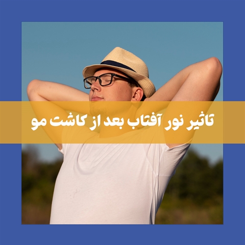 نور آفتاب بعد از کاشت مو