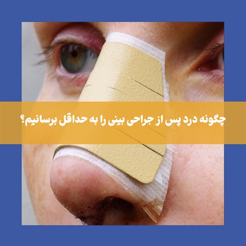برای درد پس از جراحی بینی چه باید کرد؟