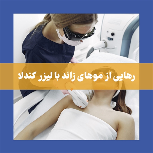 همه چیز در مورد لیزر کندلا