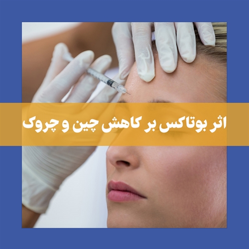 کاربردهای بوتاکس در رفع چین و چروک پوست و عوارض احتمالی آن