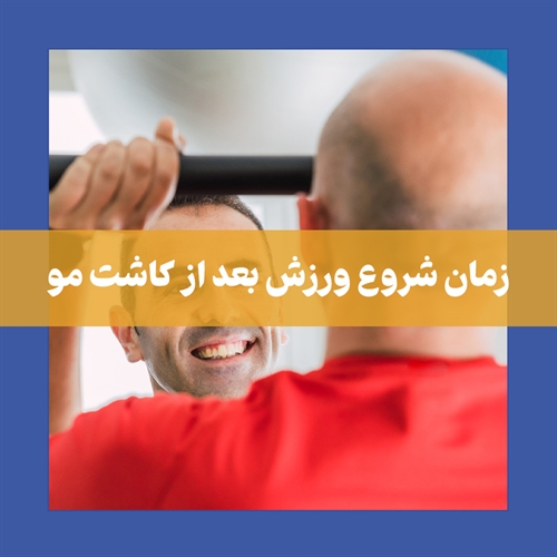 زمان مناسب برای شروع ورزش بعد از کاشت مو
