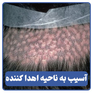  آسیب به ناحیه اهدا کننده