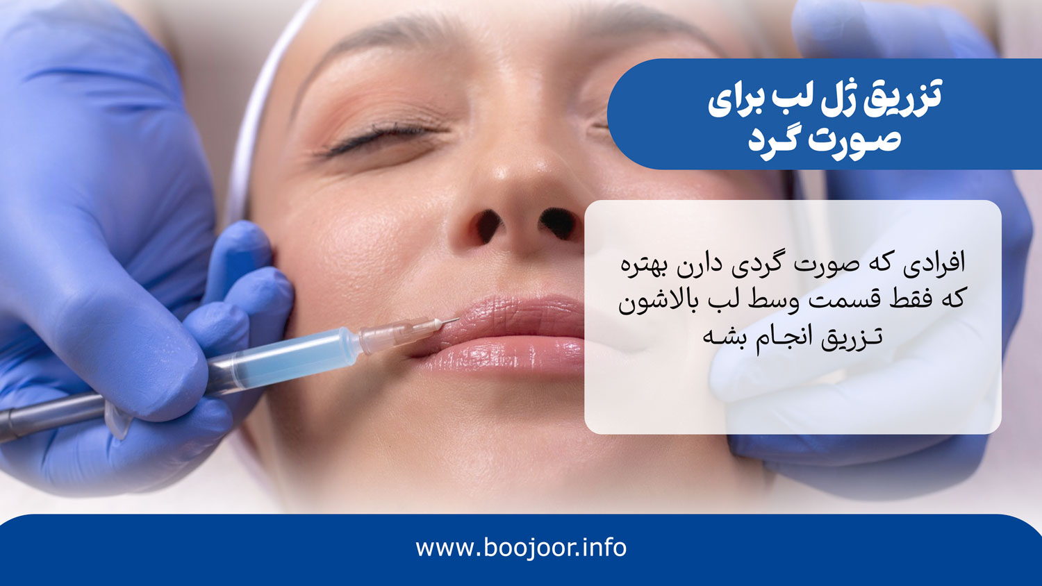 ژل لب برای صورت گرد