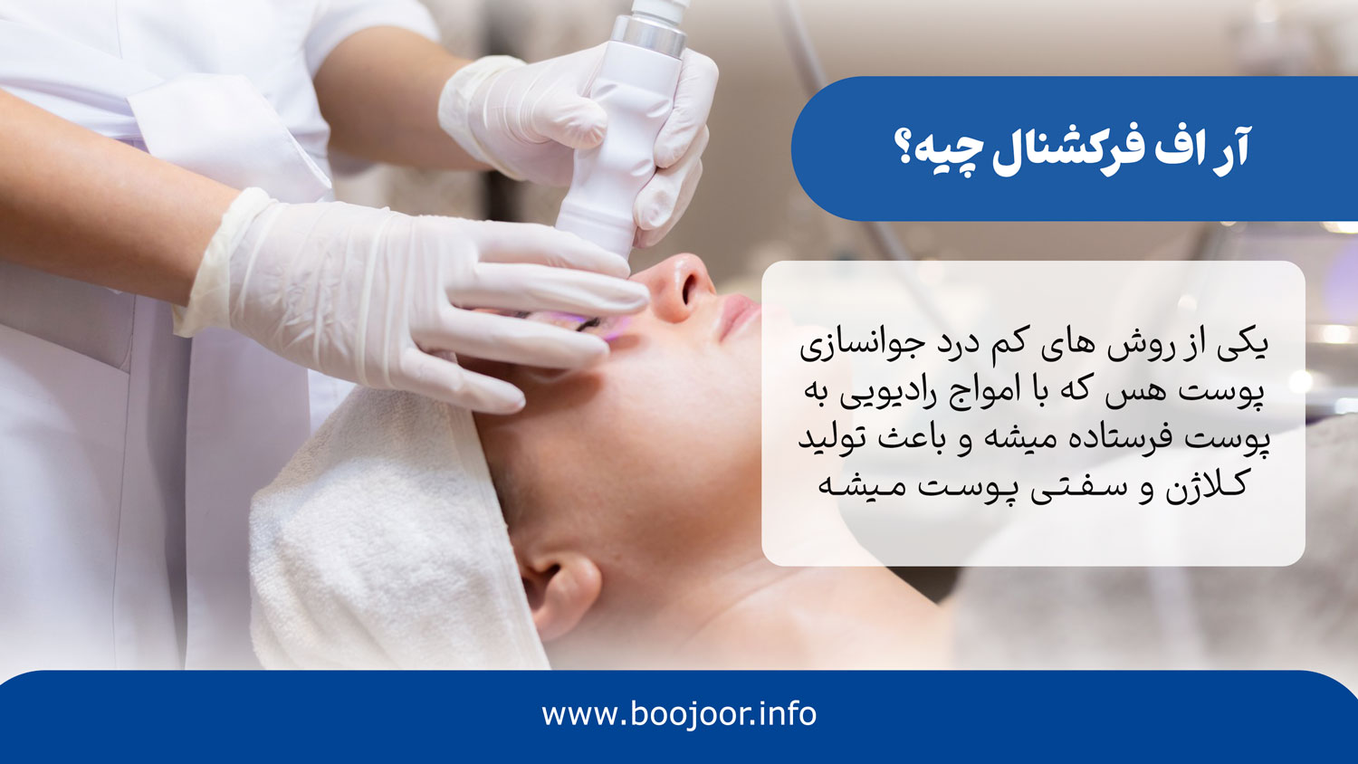 آر اف فرکشنال چیه