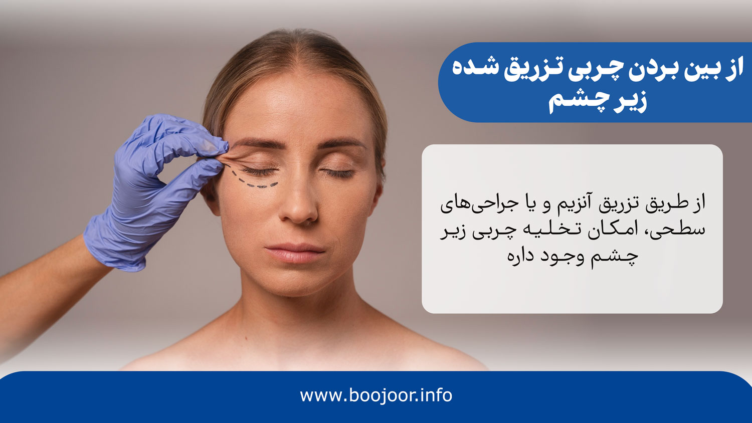 از بین بردن چربی تزریق شده زیر چشم