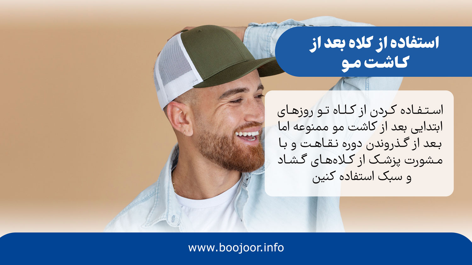 استفاده از کلاه بعد از کاشت مو