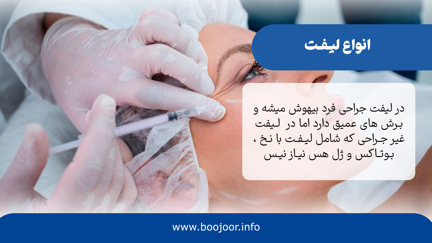 انواع لیفت