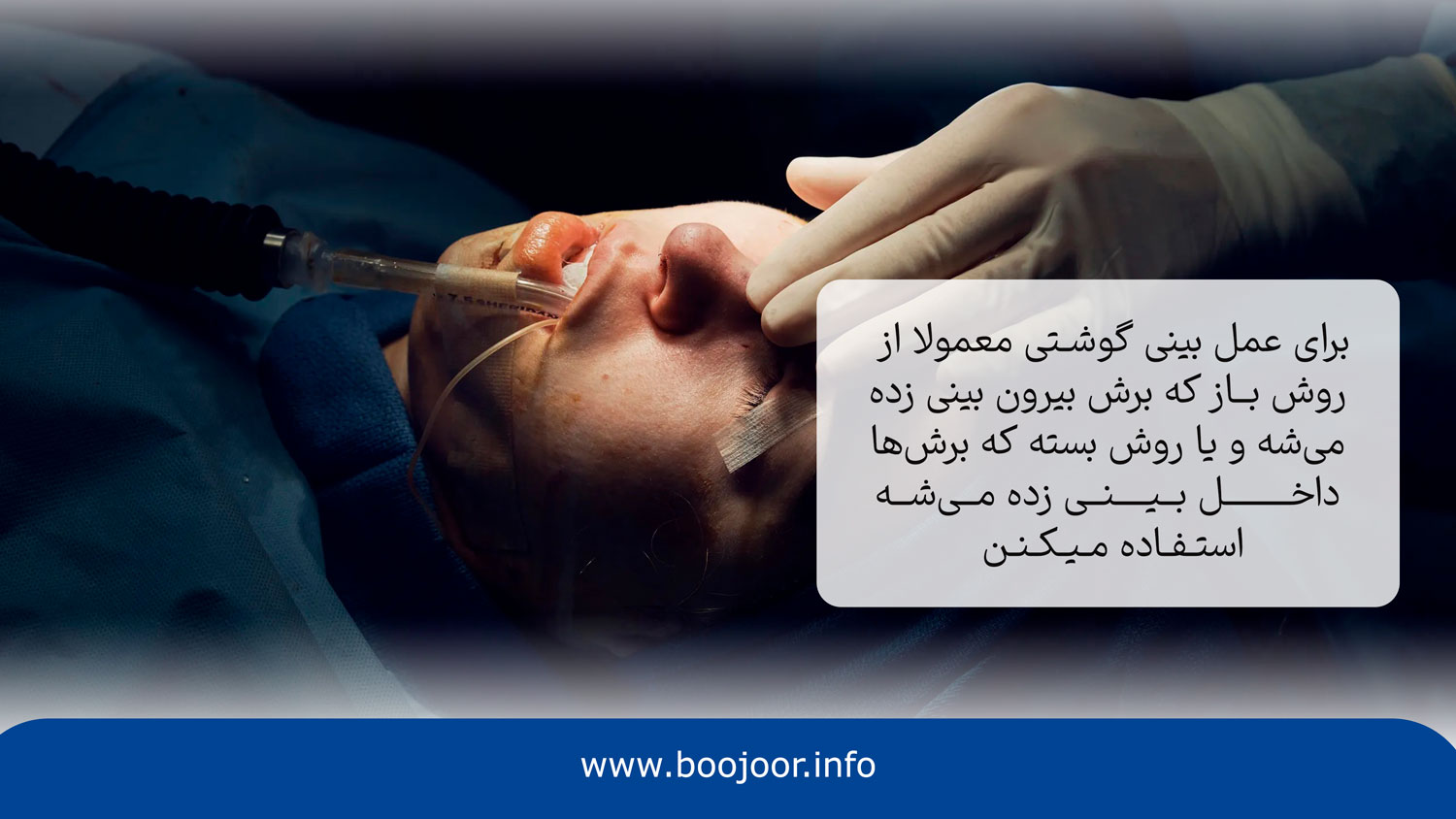 ایجاد برش در عمل بینی گوشتی یکی از مراحل عمل بینی گوشتی