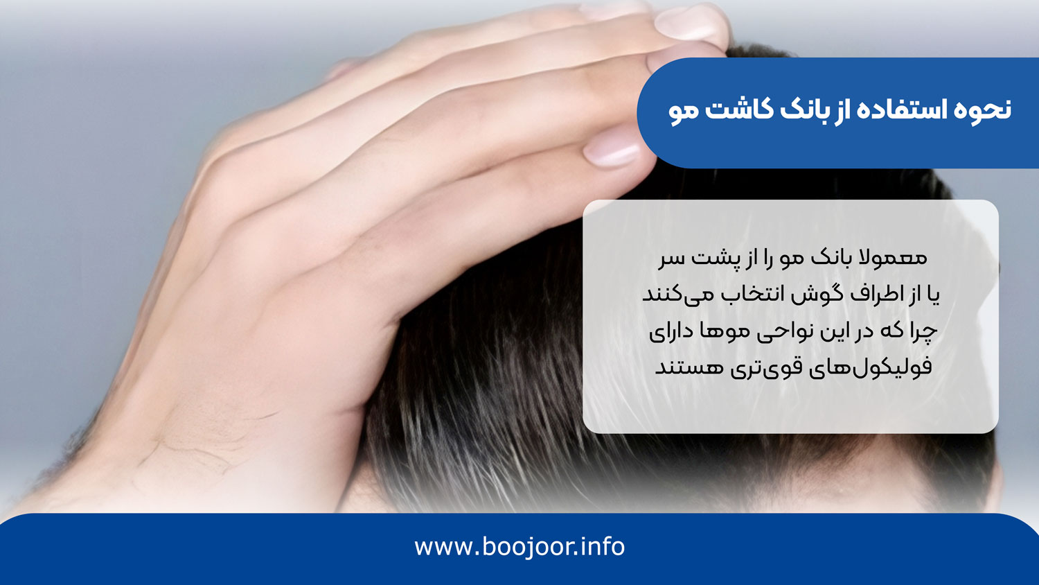 نحوه استفاده از بانک کاشت مو در کاشت مو و ابرو