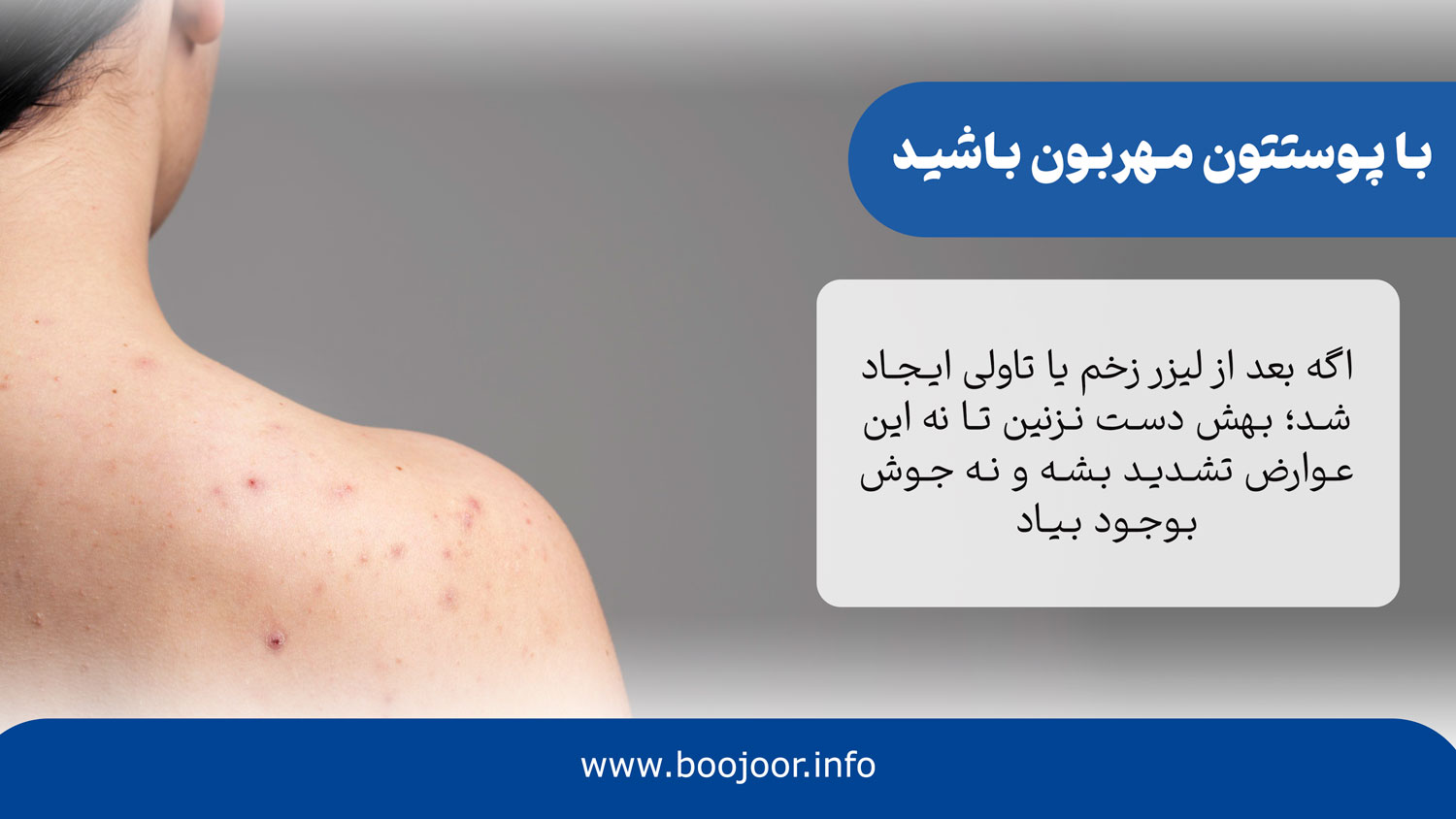 با پوستتون مهربون باشید
