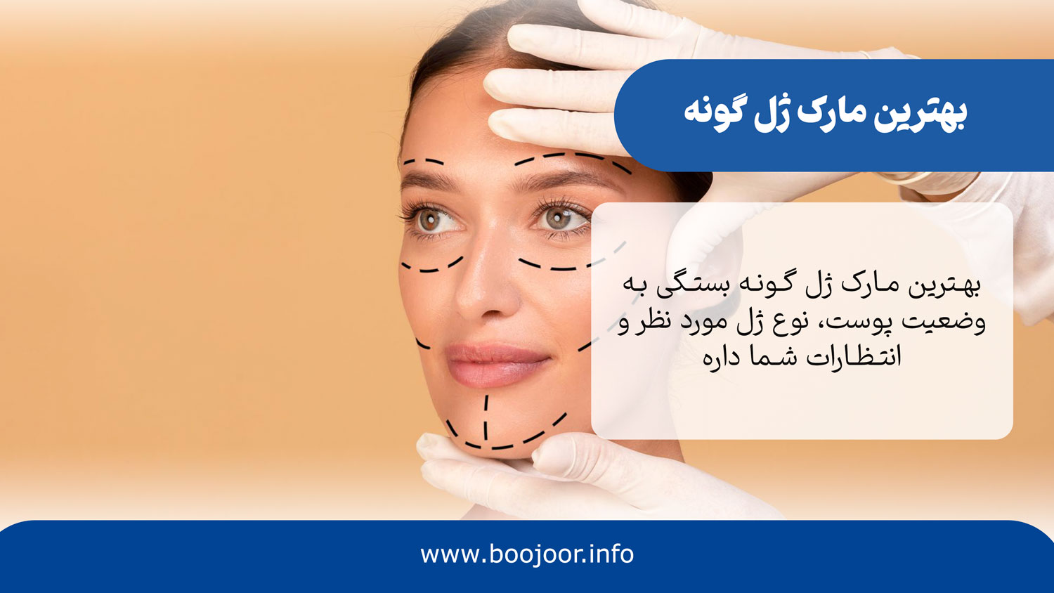 بهترین مارک ژل گونه