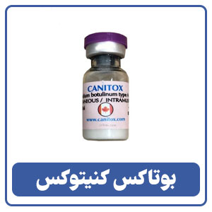 بوتاکس کنیتوکس