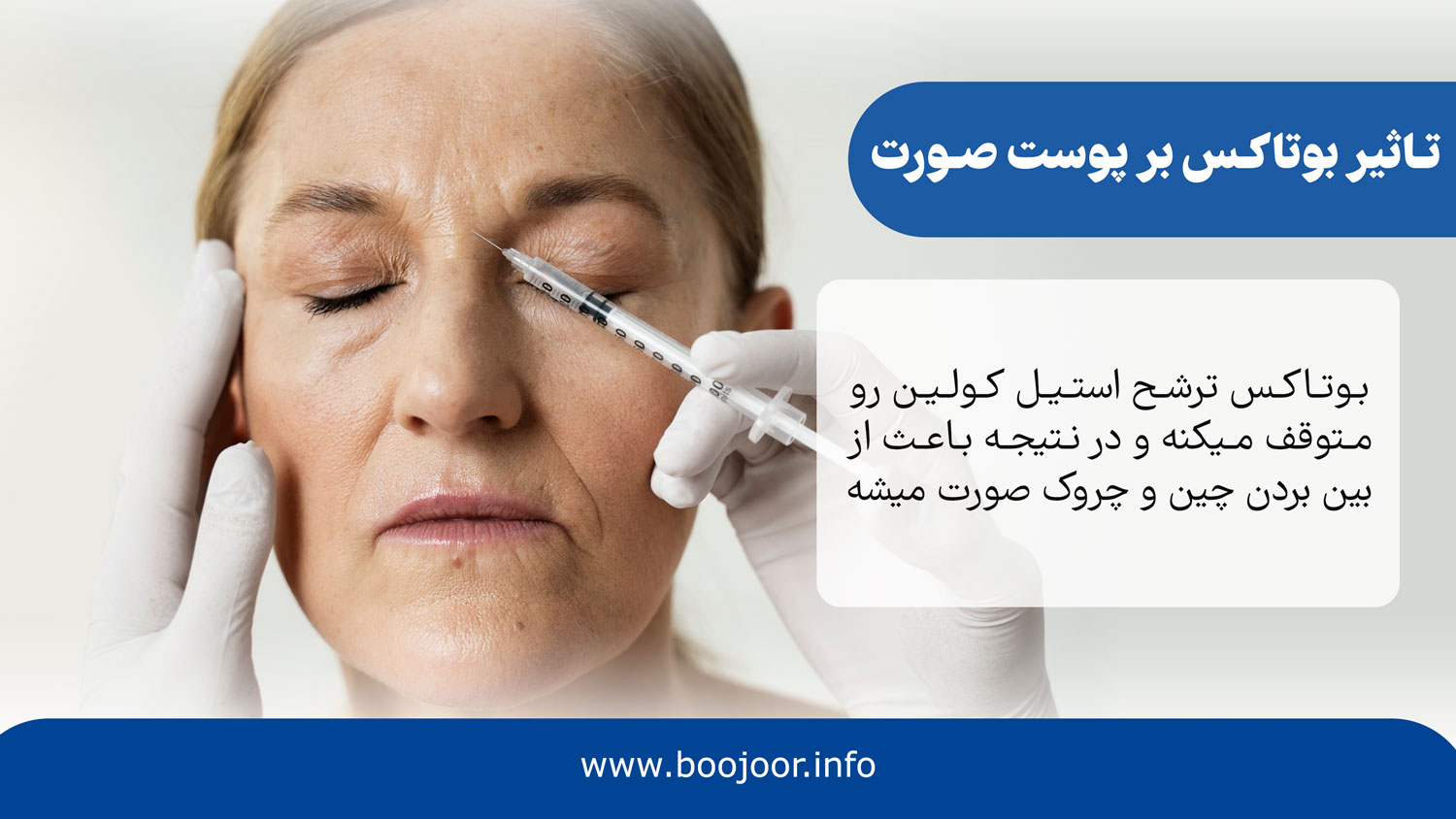 تاثیر بوتاکس بر پوست صورت