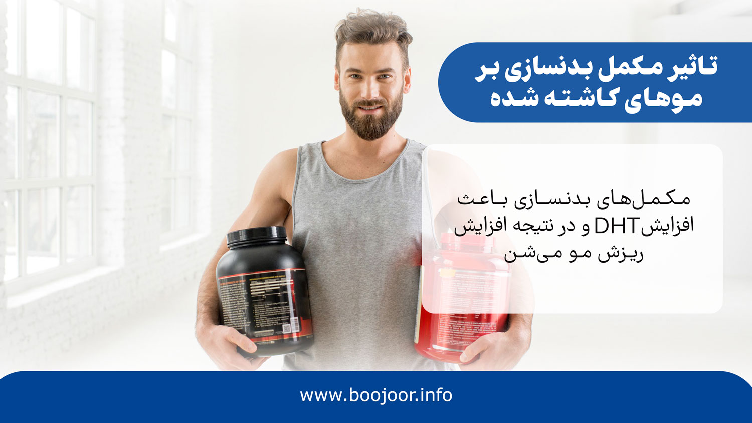 تاثیر مکمل بدنسازی بر موهای کاشته شده