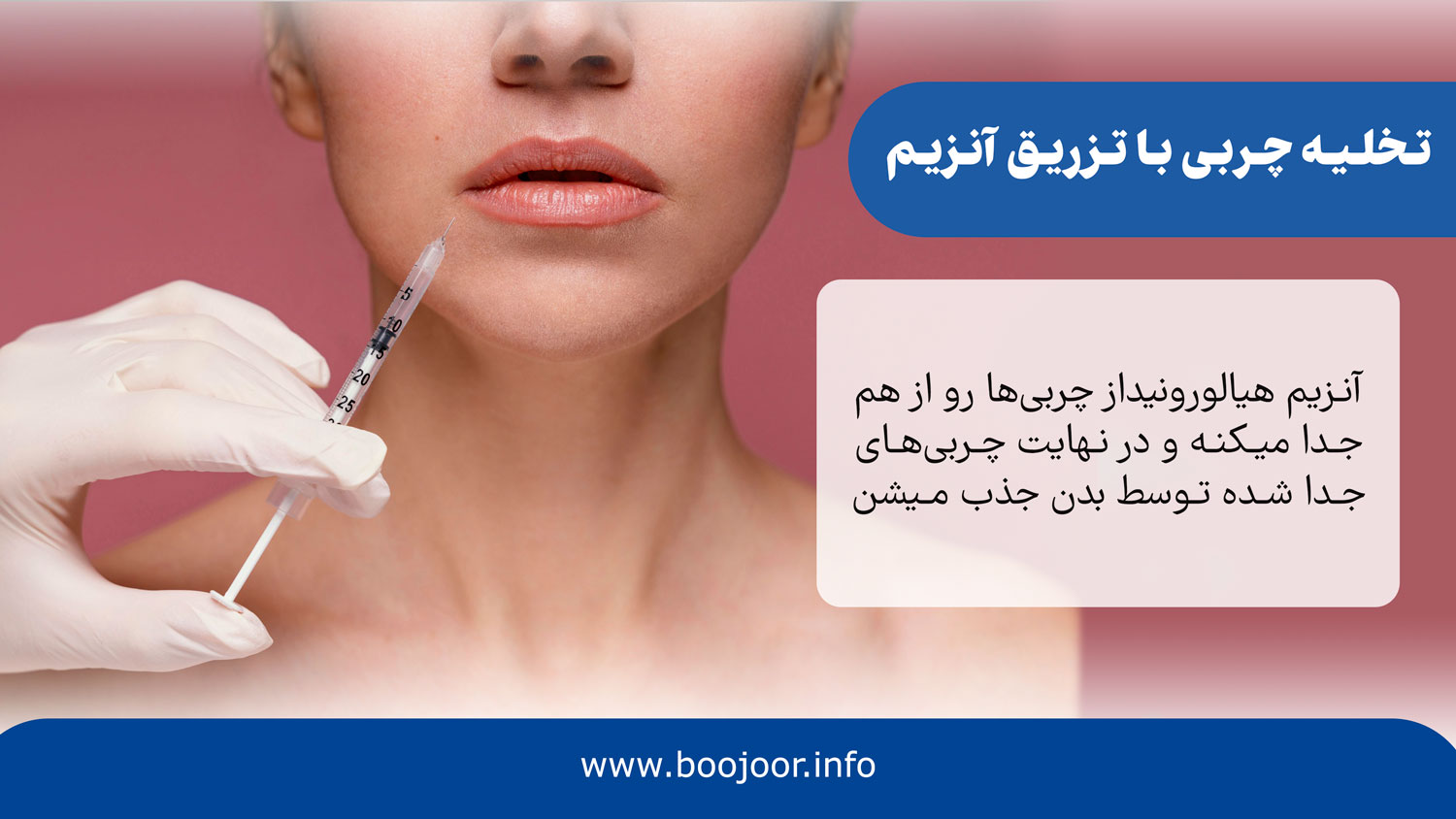 تزریق آنزیم برای تخلیه چربی