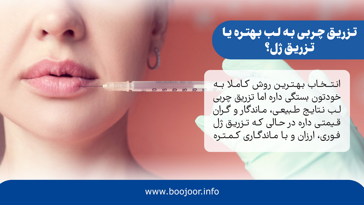 تزریق چربی لب بهتره یا تزریق ژل لب؟