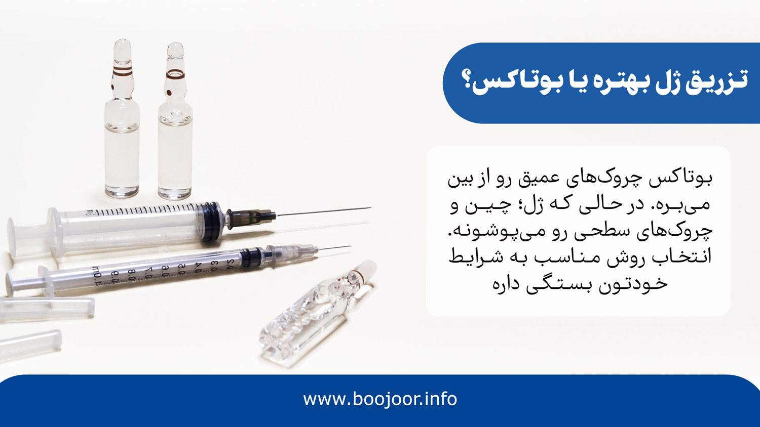 تزریق ژل بهتر است یا بوتاکس؟