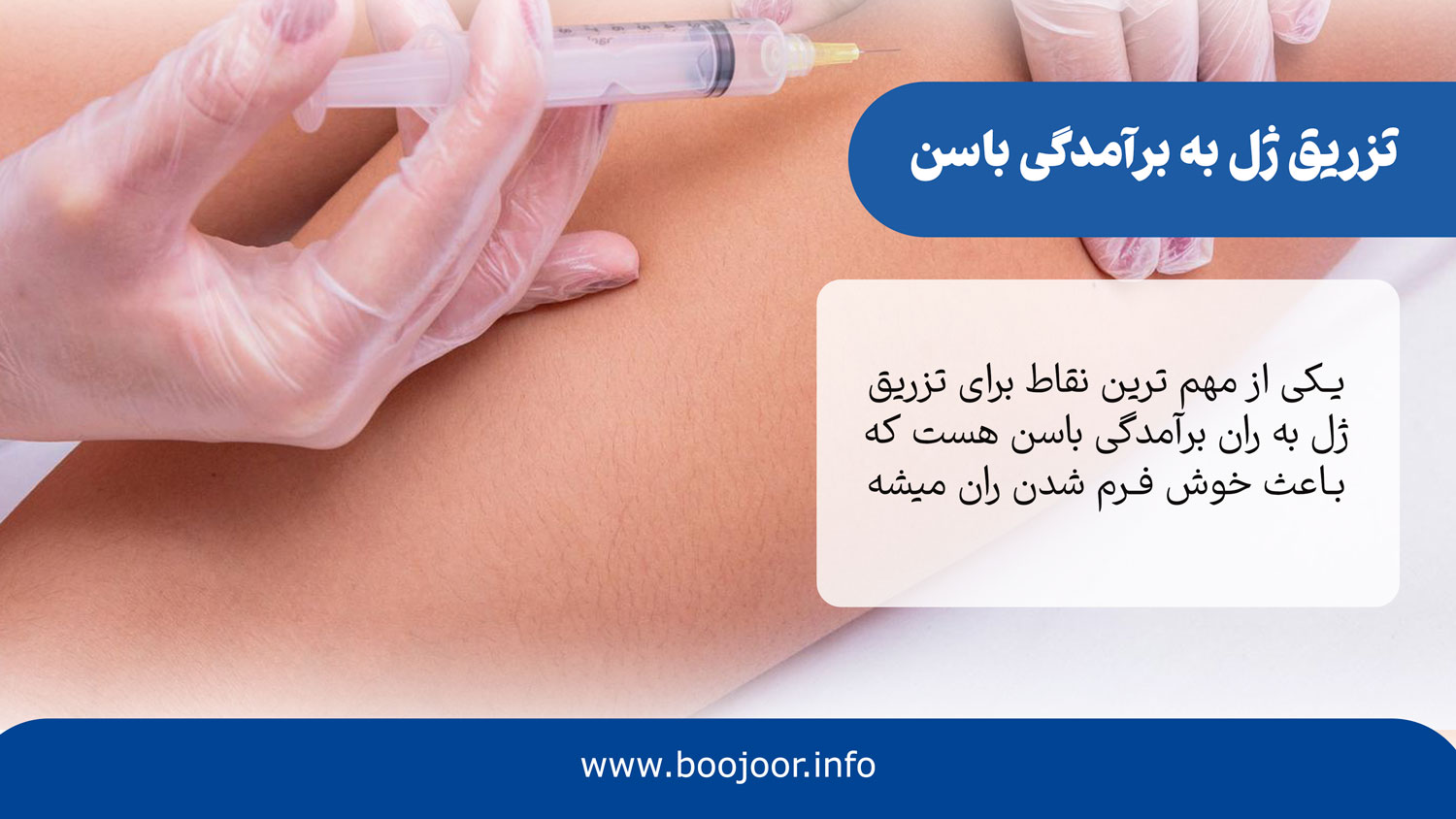 تزریق ژل به برامدگی باسن