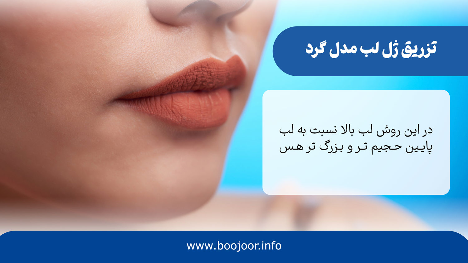 تزریق ژل لب مدل گرد