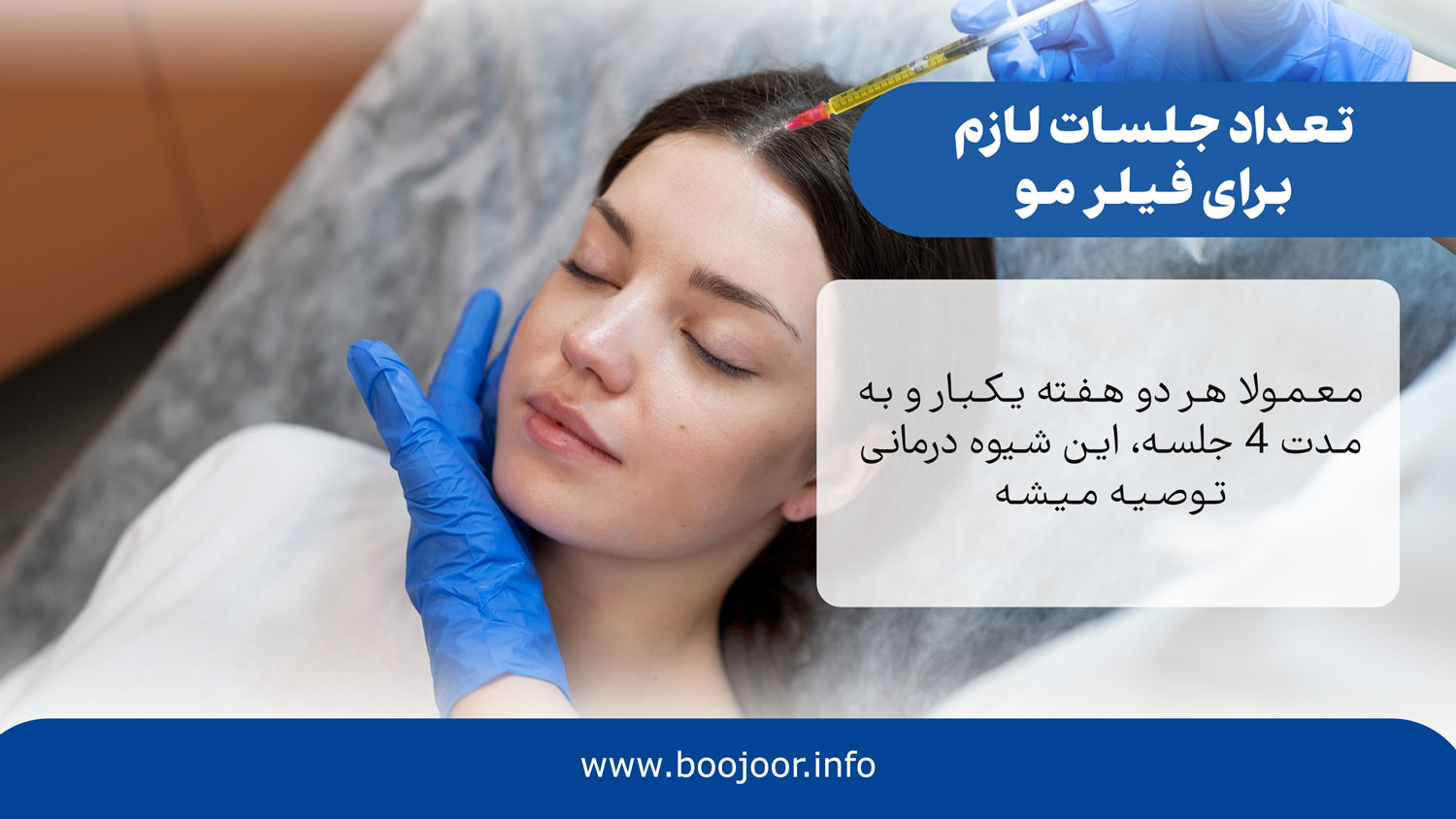 تعداد جلسات لازم برای فیلر مو