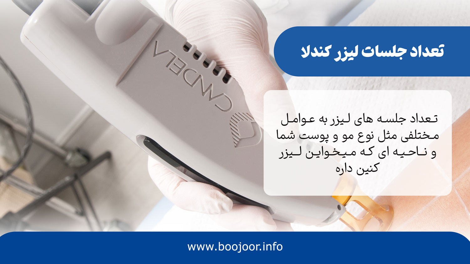 تعداد جلسات لیزر کندلا